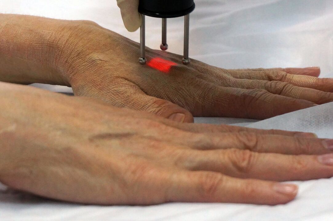 Лазерне омолодження кистей рук неабляційним методом